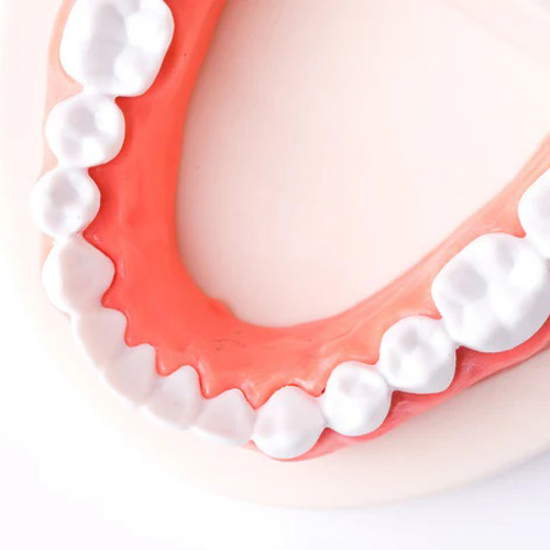 دندان-مصنوعی-ژله-ای-بهتر-است-یا-معمولی